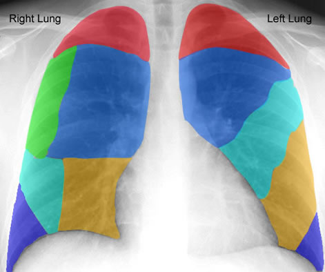 Lung Segments Anatomy - Anatomy Drawing Diagram